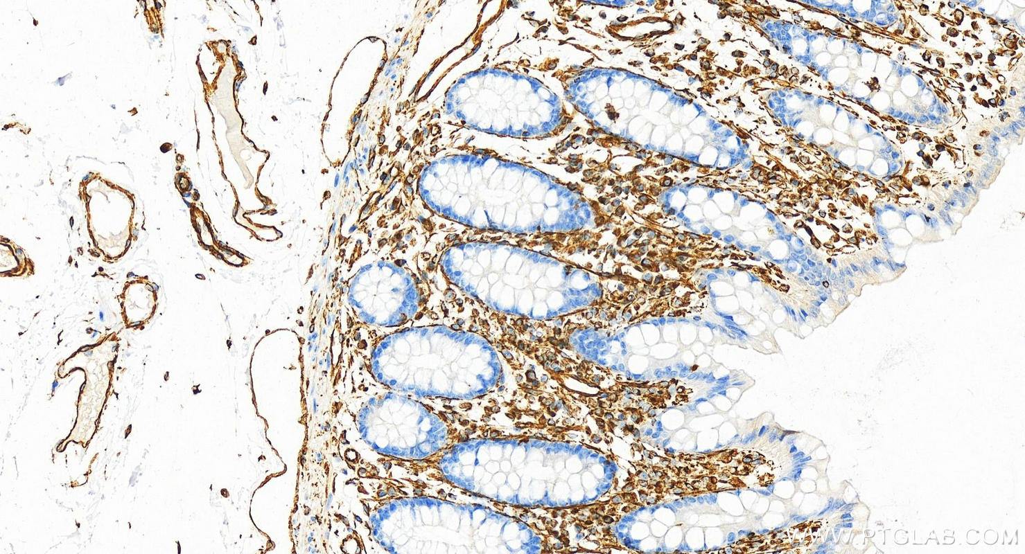 Immunohistochemistry (IHC) staining of human colon tissue using Vimentin Recombinant antibody (80232-1-RR)