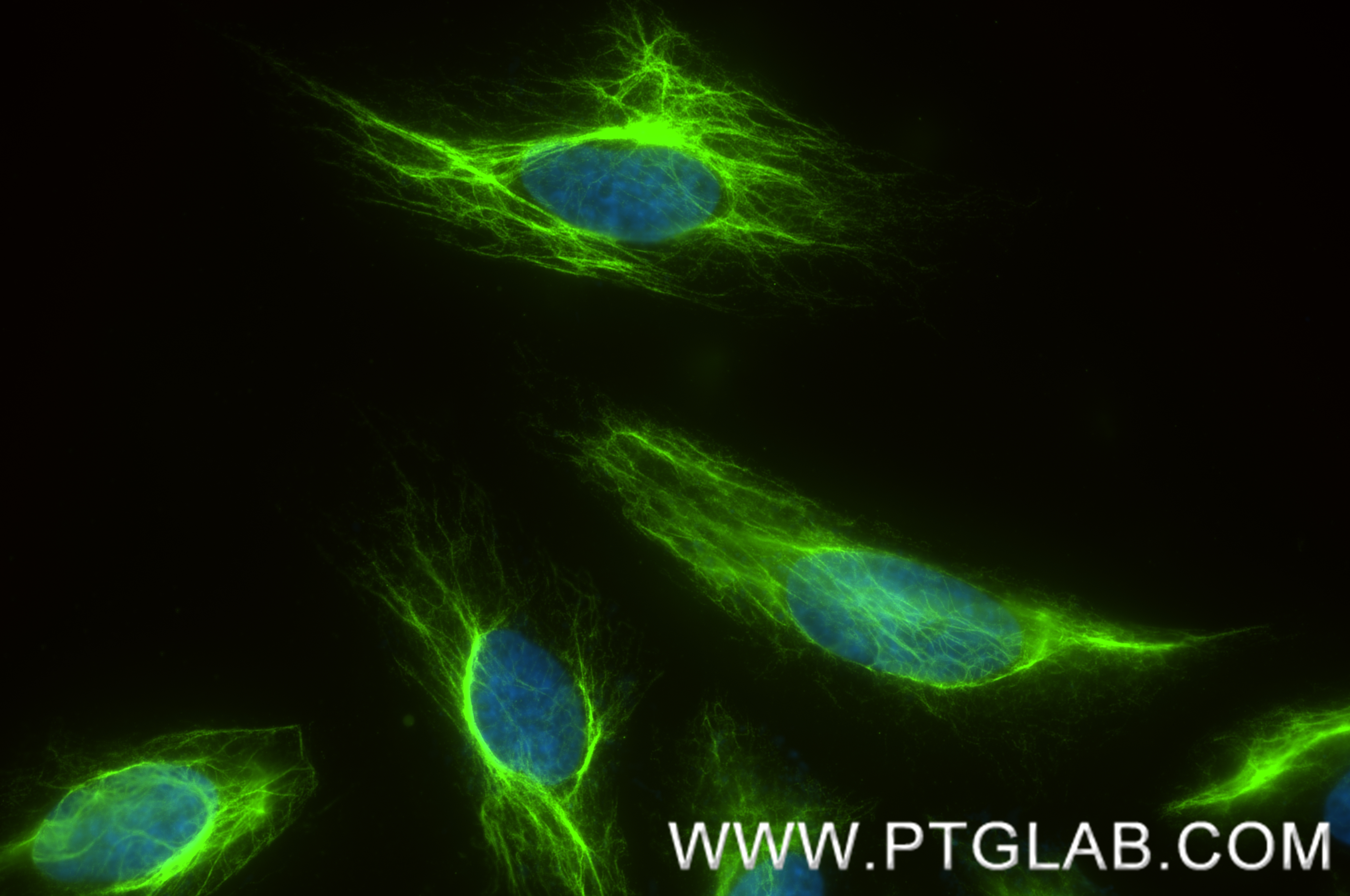 Immunofluorescence (IF) / fluorescent staining of HeLa cells using Vimentin Recombinant antibody (80232-1-RR)