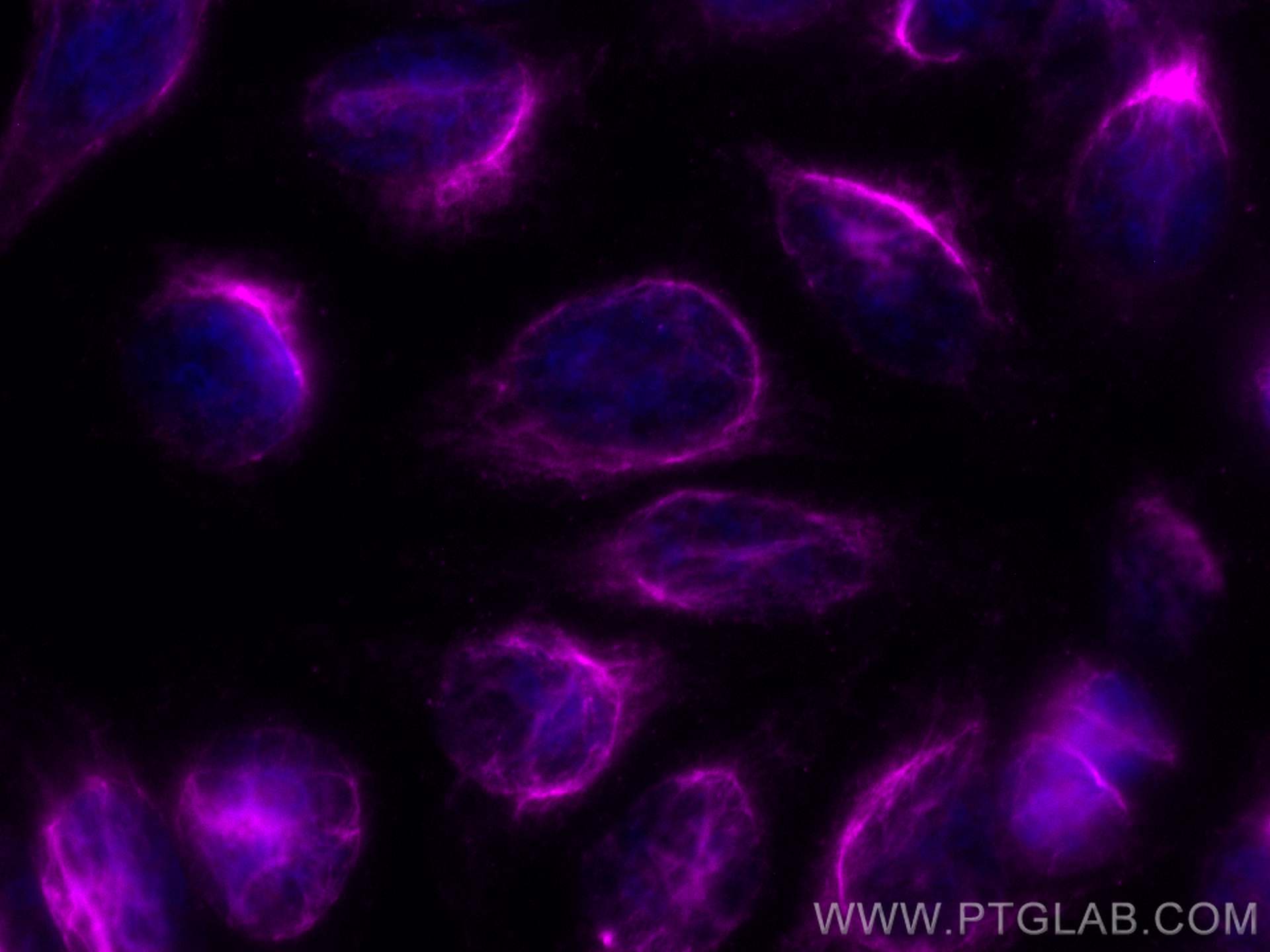 Immunofluorescence (IF) / fluorescent staining of HepG2 cells using CoraLite® Plus 647-conjugated Vimentin Recombinant (CL647-80232)