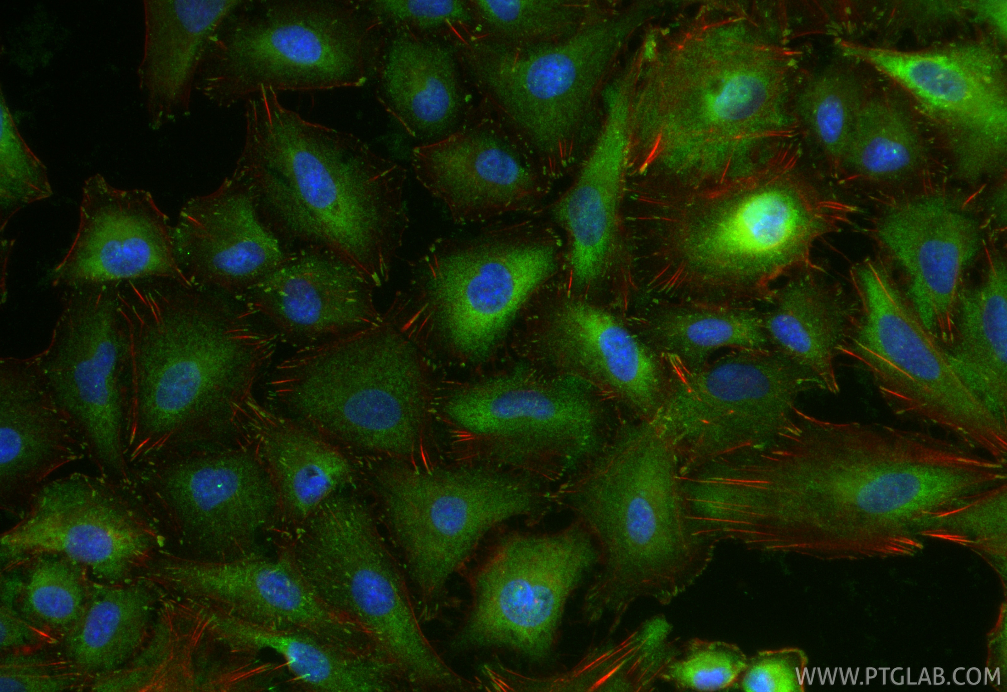 Immunofluorescence (IF) / fluorescent staining of A549 cells using Vinculin Polyclonal antibody (26520-1-AP)