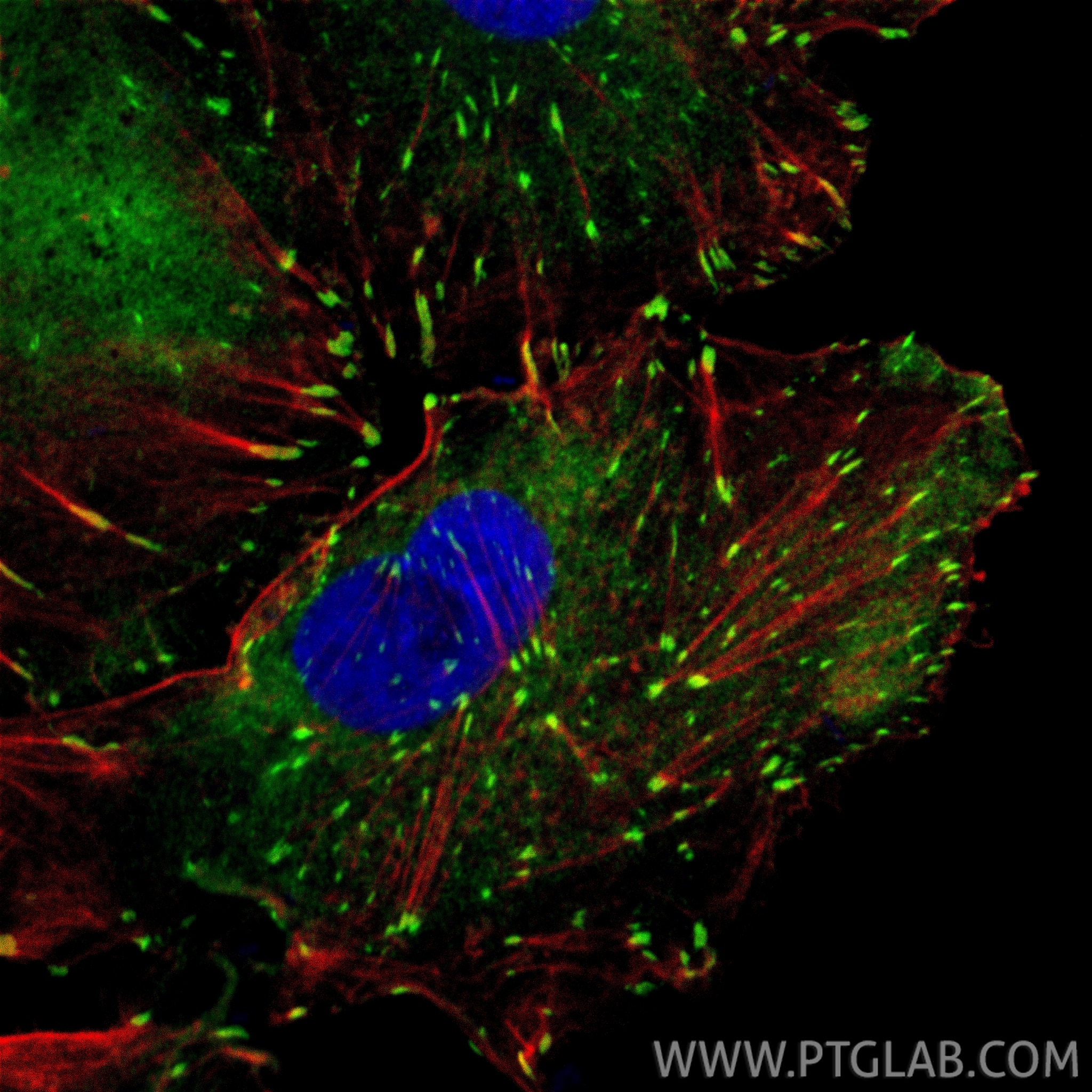 Immunofluorescence (IF) / fluorescent staining of A549 cells using Vinculin Polyclonal antibody (26520-1-AP)