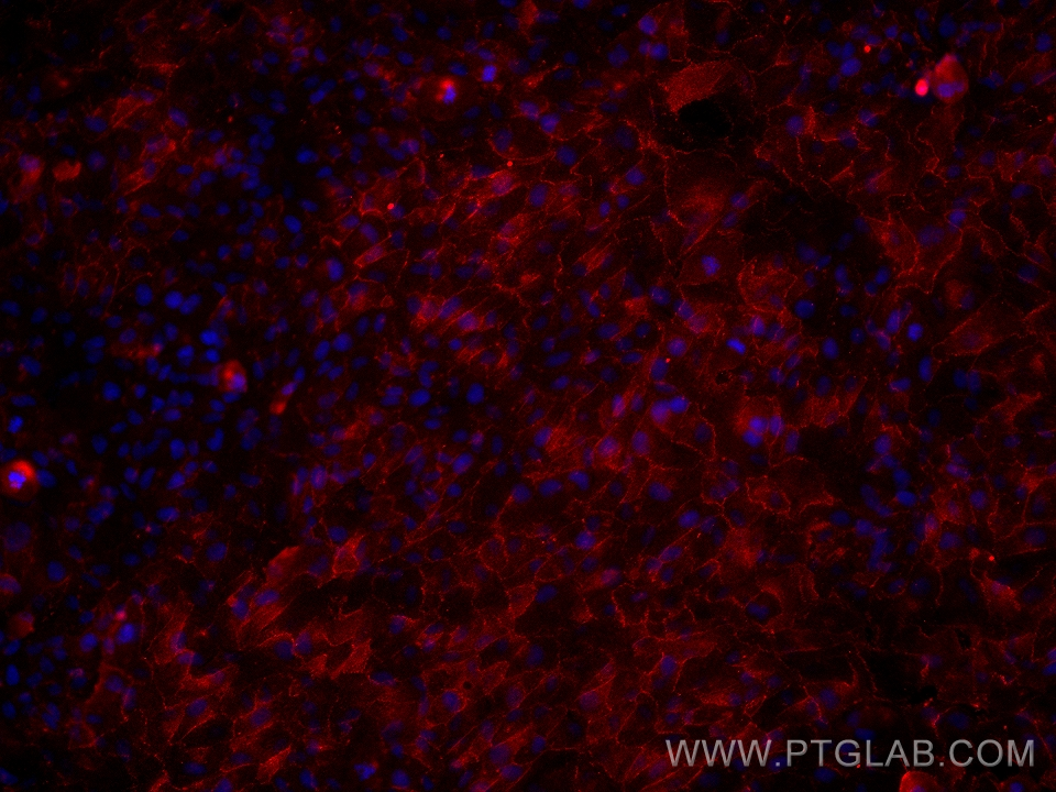 Immunofluorescence (IF) / fluorescent staining of hTERT-RPE1 cells using Vinculin Monoclonal antibody (66305-2-Ig)