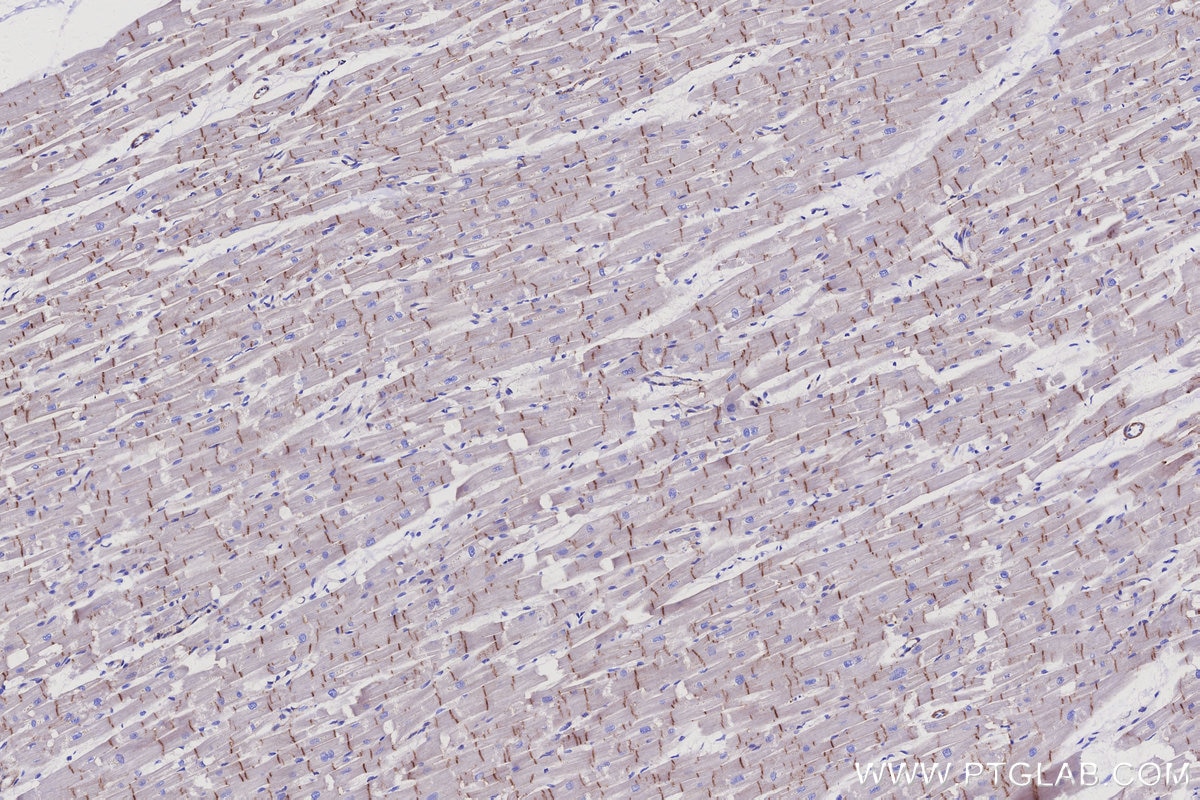 Immunohistochemistry (IHC) staining of human heart tissue using Vinculin Monoclonal antibody (66305-2-Ig)