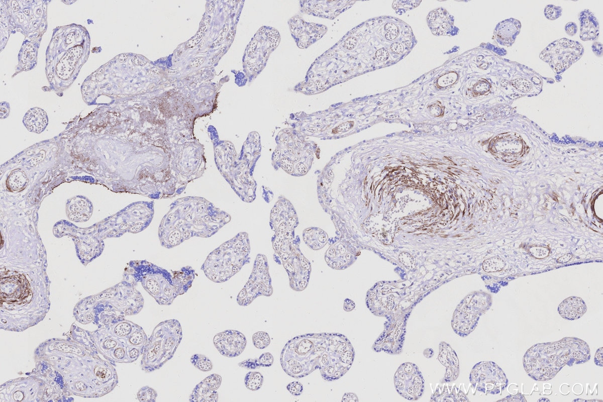 Immunohistochemistry (IHC) staining of human placenta tissue using Vinculin Monoclonal antibody (66305-2-Ig)