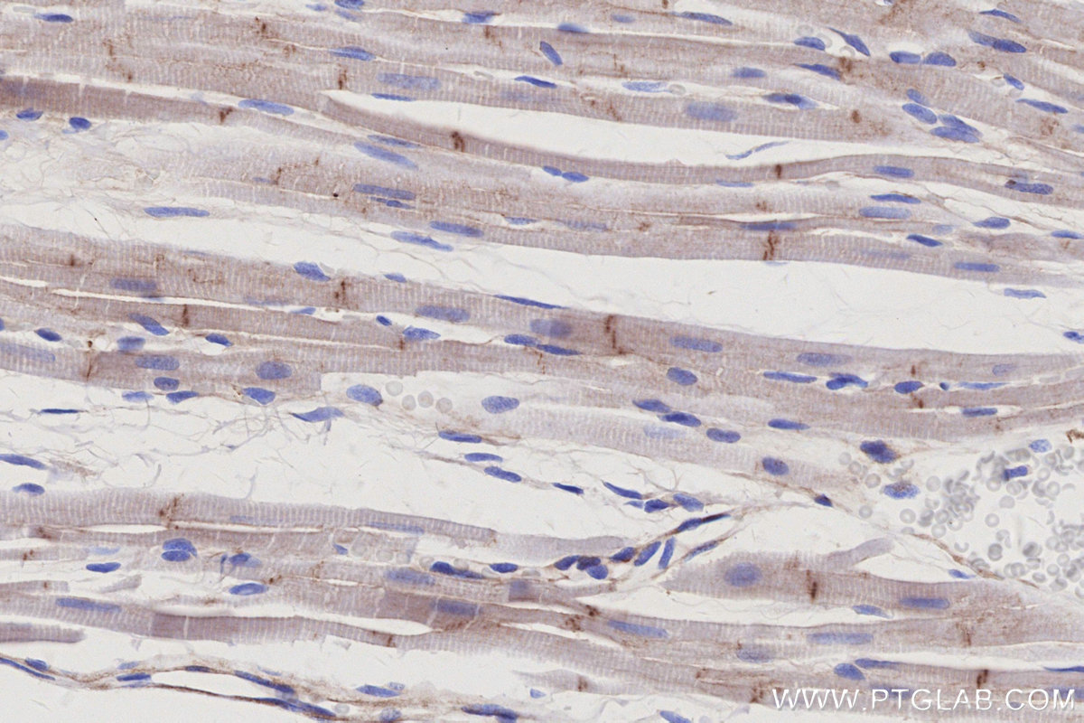 Immunohistochemistry (IHC) staining of rat heart tissue using Vinculin Monoclonal antibody (66305-2-Ig)