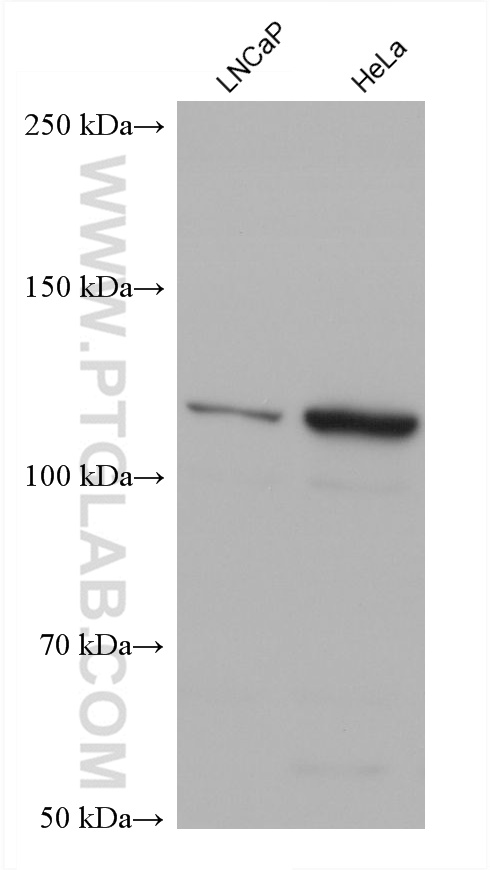 Western Blot (WB) analysis of various lysates using Vinculin Monoclonal antibody (66305-2-Ig)