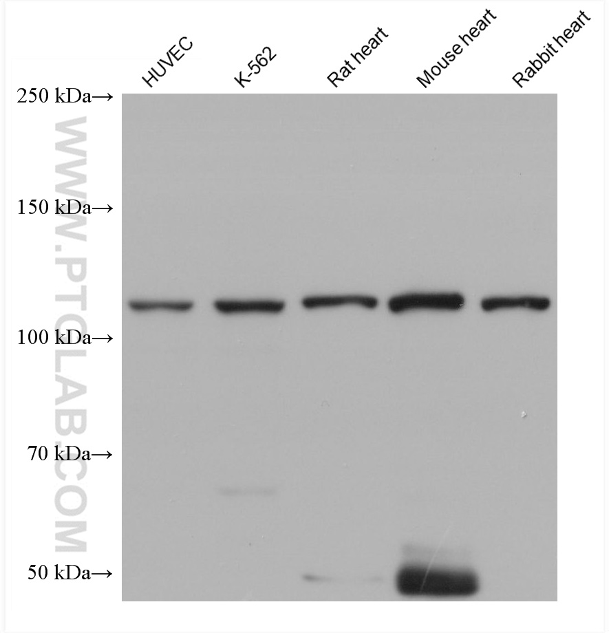 Western Blot (WB) analysis of various lysates using Vinculin Monoclonal antibody (66305-2-Ig)