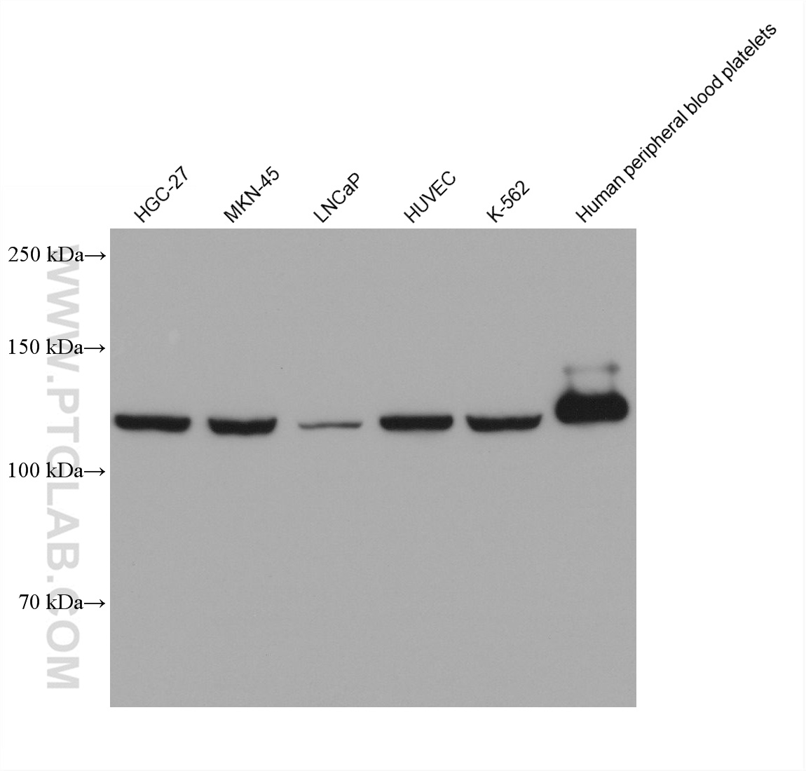 Western Blot (WB) analysis of various lysates using Vinculin Monoclonal antibody (66305-2-Ig)