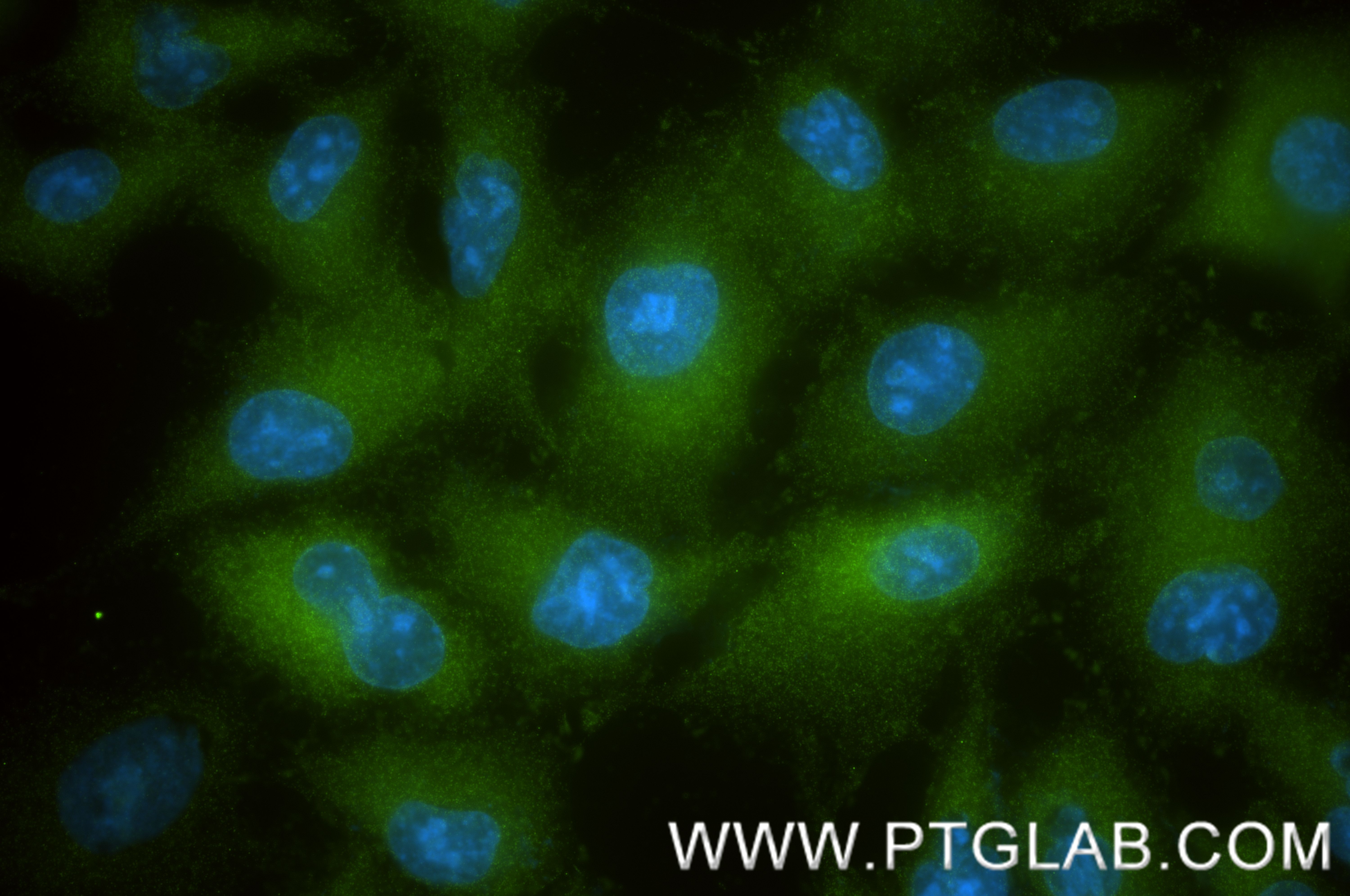 Immunofluorescence (IF) / fluorescent staining of A549 cells using Vinculin Recombinant monoclonal antibody (86930-1-RR)