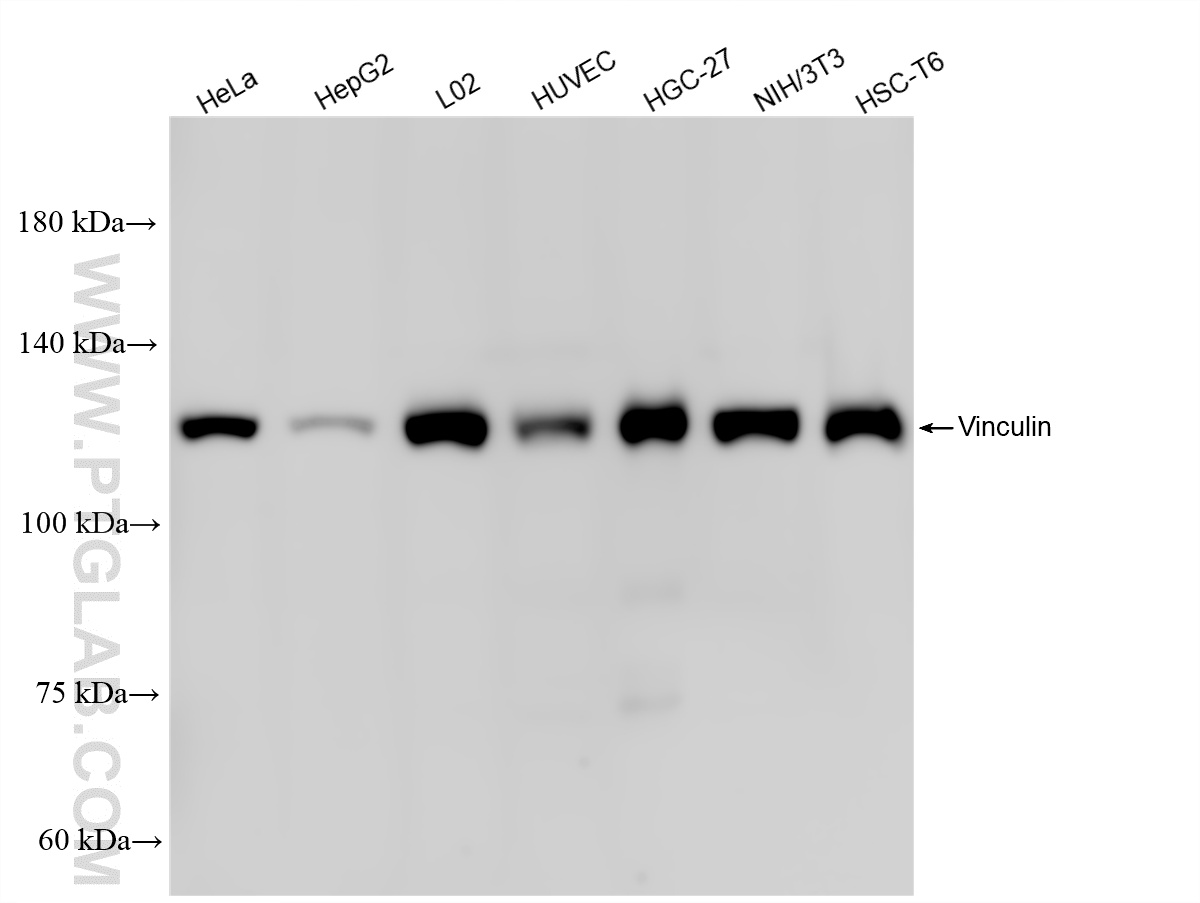 Western Blot (WB) analysis of various lysates using Vinculin Recombinant monoclonal antibody (86930-1-RR)