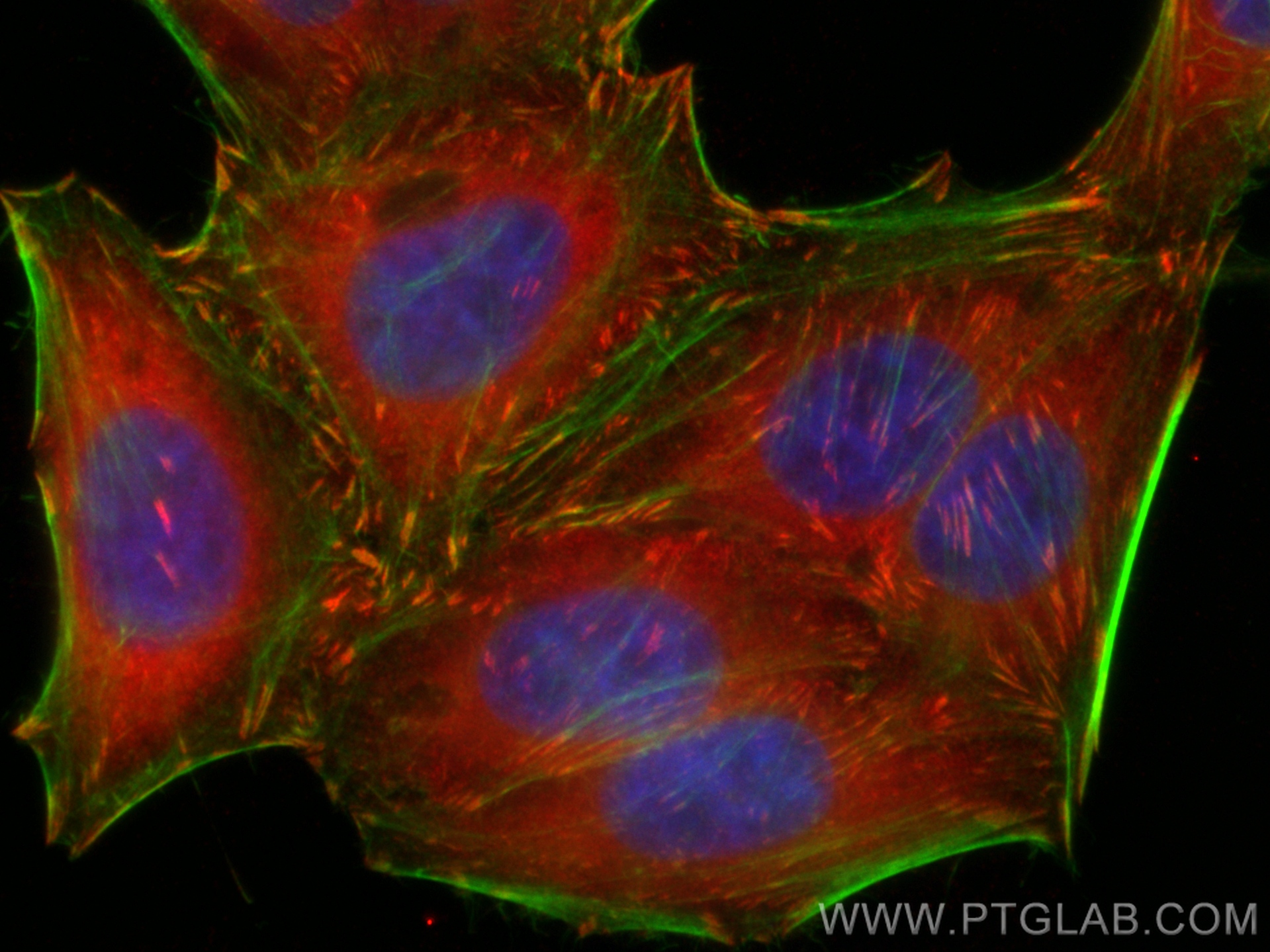 Immunofluorescence (IF) / fluorescent staining of HepG2 cells using CoraLite®594-conjugated Vinculin Polyclonal antibo (CL594-26520)