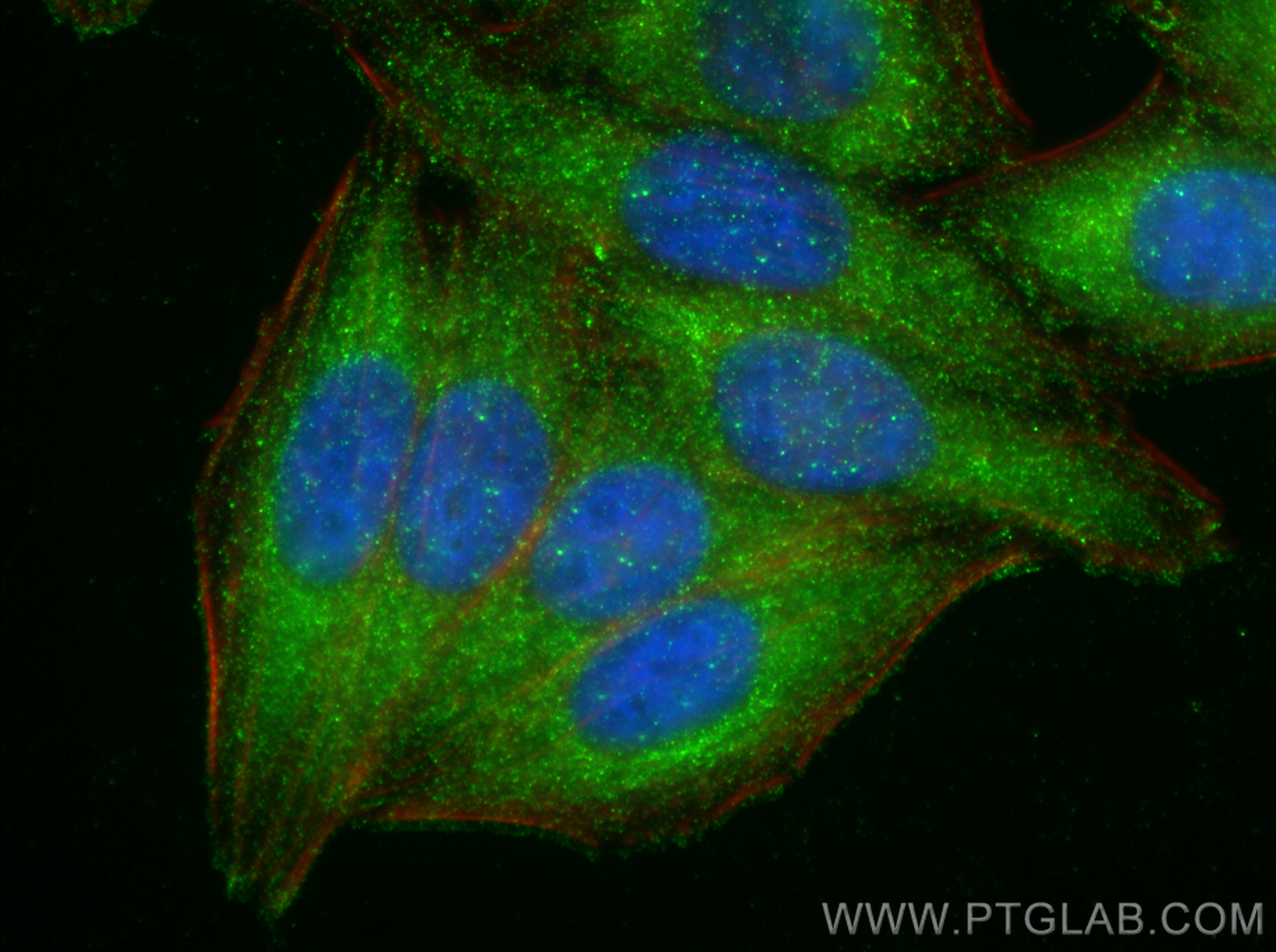 Immunofluorescence (IF) / fluorescent staining of HepG2 cells using Vitamin D binding protein Monoclonal antibody (66175-1-Ig)