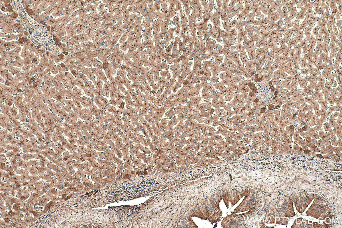 Immunohistochemistry (IHC) staining of human liver tissue using Vitamin D binding protein Monoclonal antibody (66175-1-Ig)