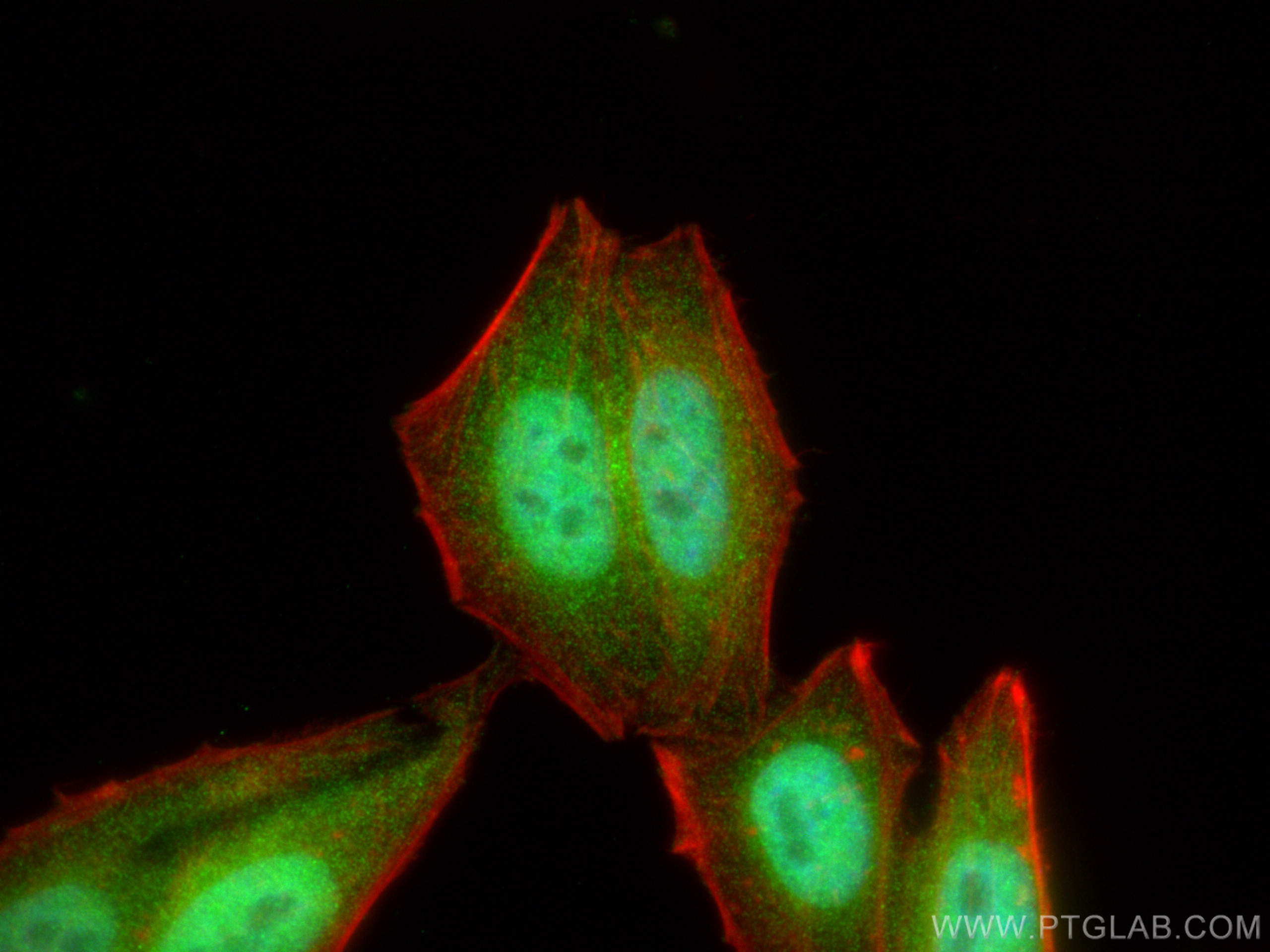 Immunofluorescence (IF) / fluorescent staining of HepG2 cells using WAPL/FOE Polyclonal antibody (16370-1-AP)