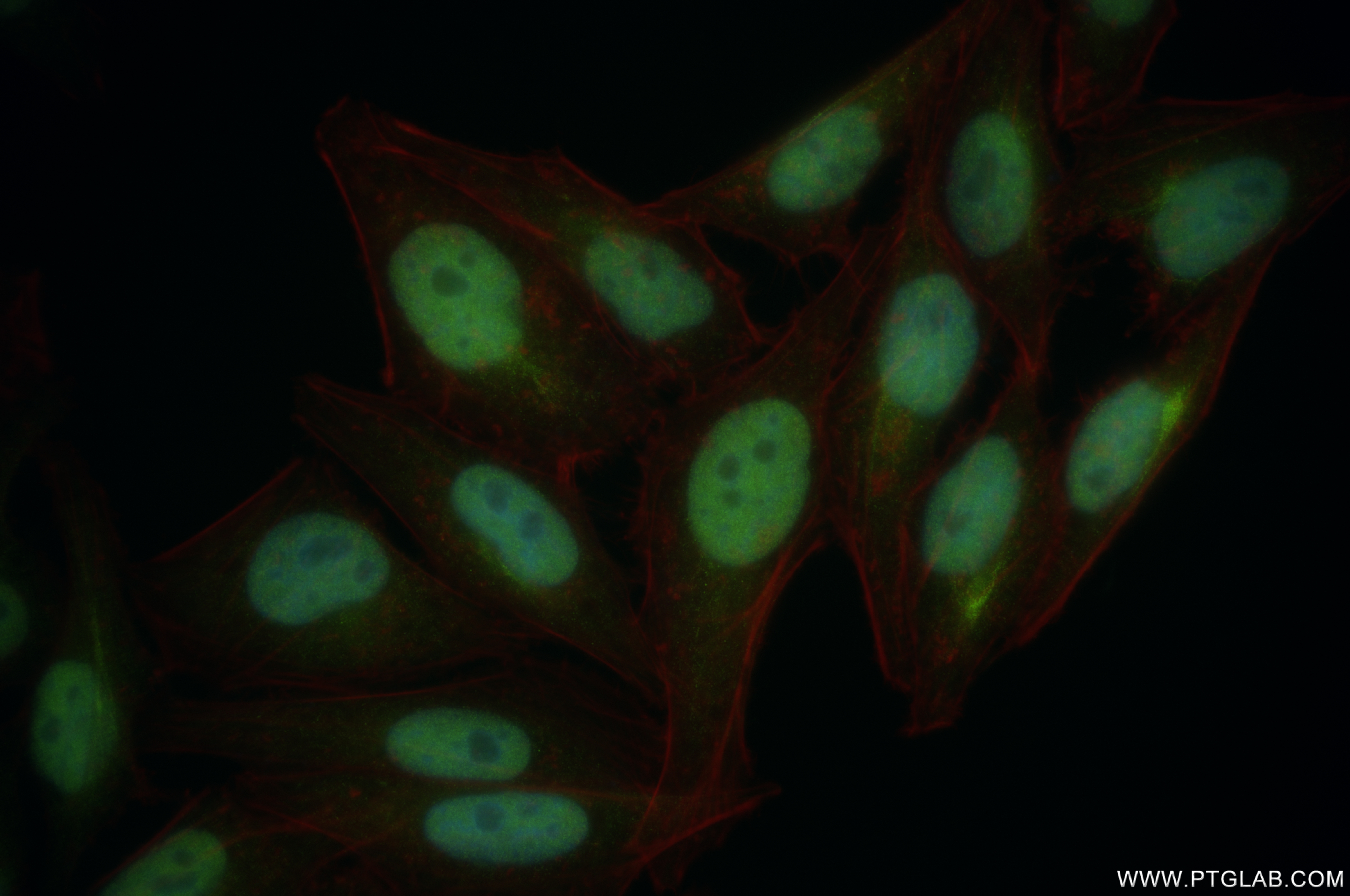 Immunofluorescence (IF) / fluorescent staining of HepG2 cells using WAPL Recombinant antibody (84877-5-RR)