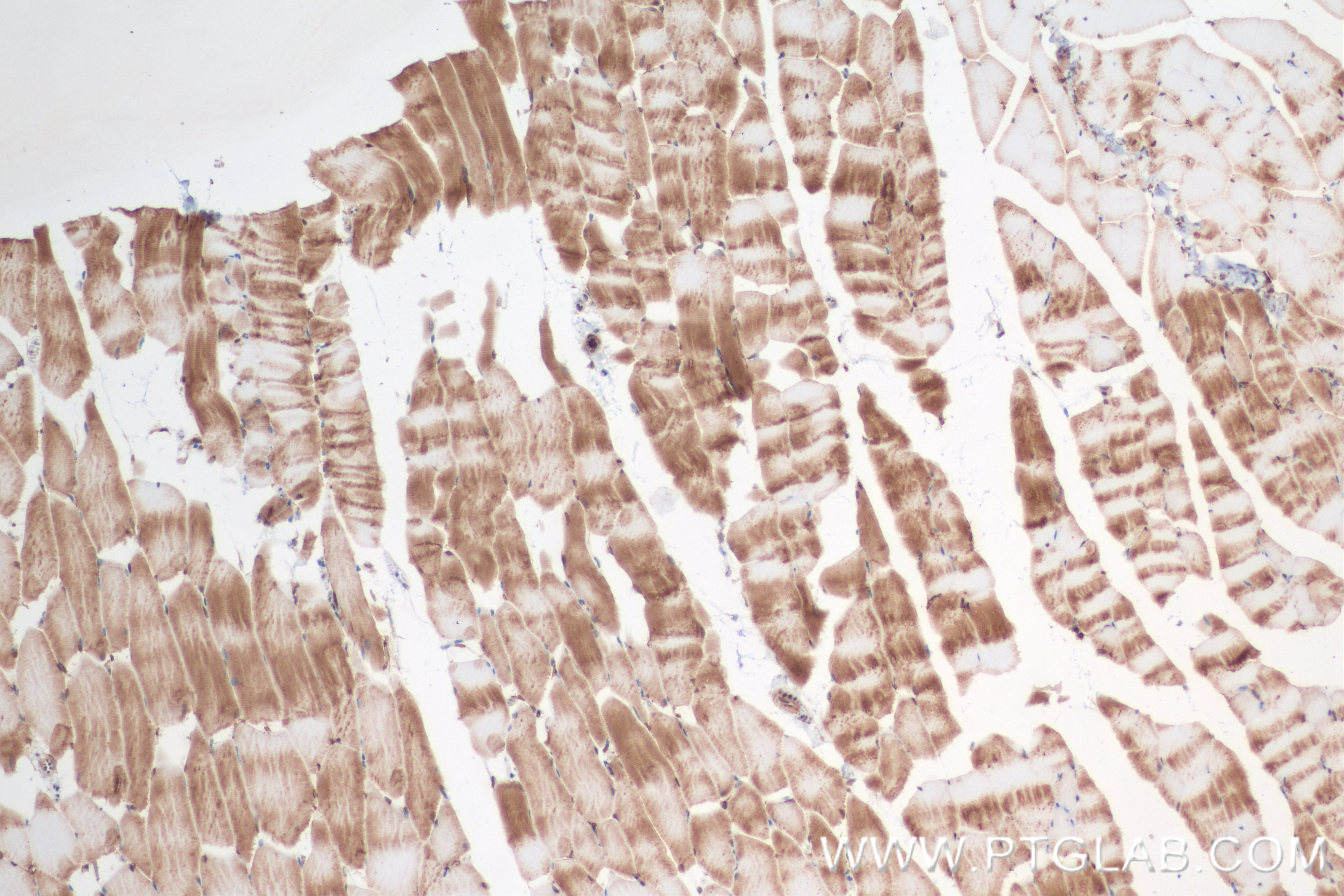 Immunohistochemistry (IHC) staining of mouse skeletal muscle tissue using WAPL Recombinant antibody (84877-5-RR)