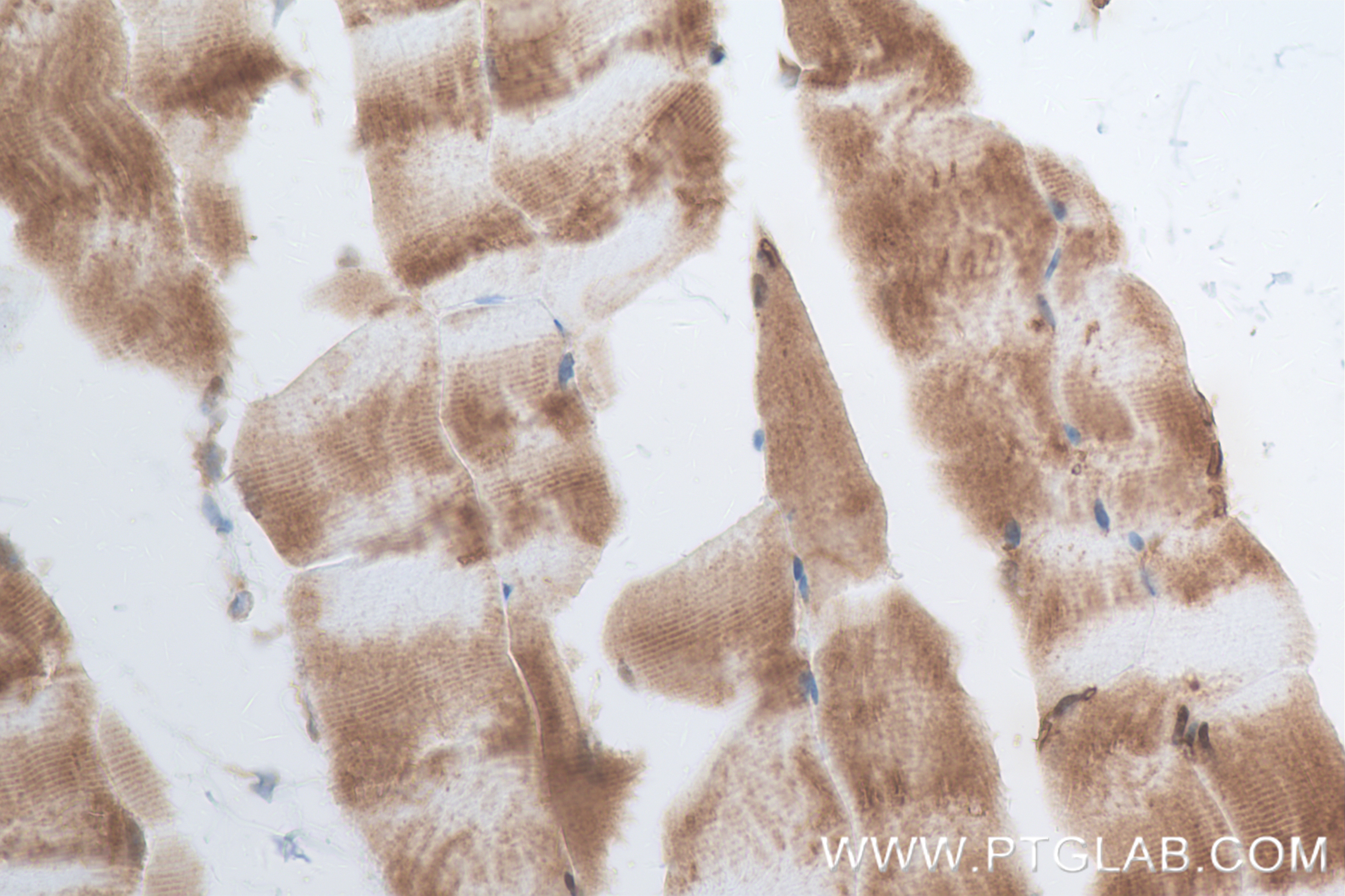 Immunohistochemistry (IHC) staining of mouse skeletal muscle tissue using WAPL Recombinant antibody (84877-5-RR)