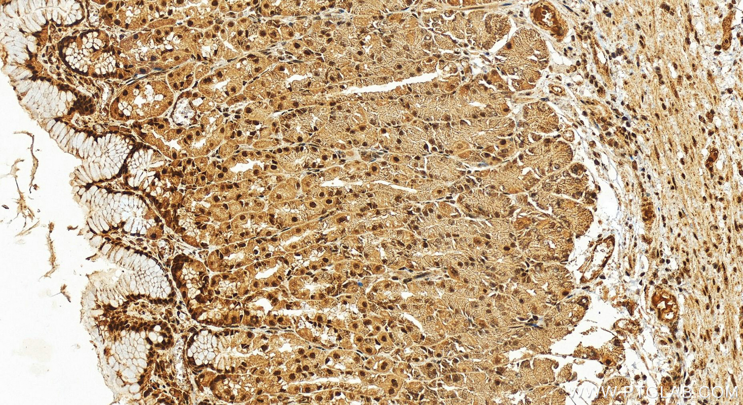 Immunohistochemistry (IHC) staining of human stomach tissue using WARS2 Polyclonal antibody (13944-1-AP)