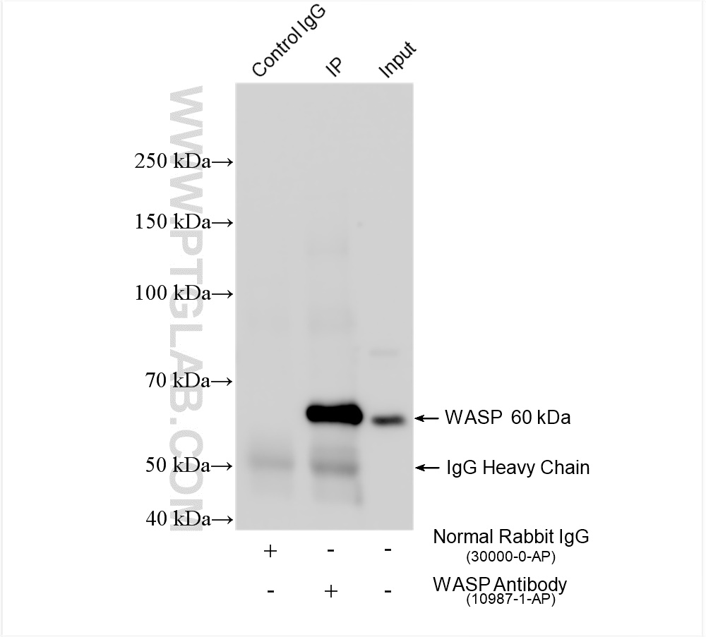 Immunoprecipitation (IP) experiment of Raji cells using WASP Polyclonal antibody (10987-1-AP)