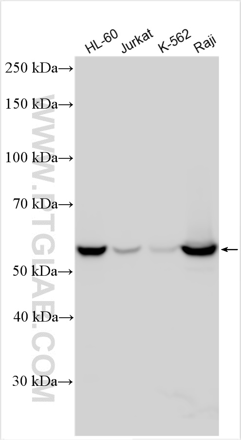 Western Blot (WB) analysis of various lysates using WASP Polyclonal antibody (10987-1-AP)