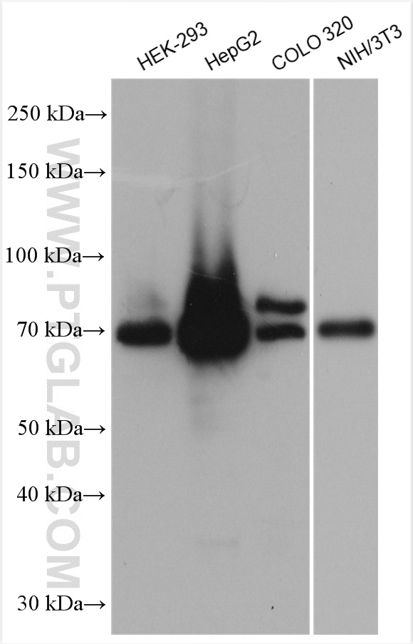 Various lysates were subjected to SDS PAGE followed by western blot with 22401-1-AP (ACSL4 antibody) at dilution of 1:6000 incubated at room temperature for 1.5 hours.