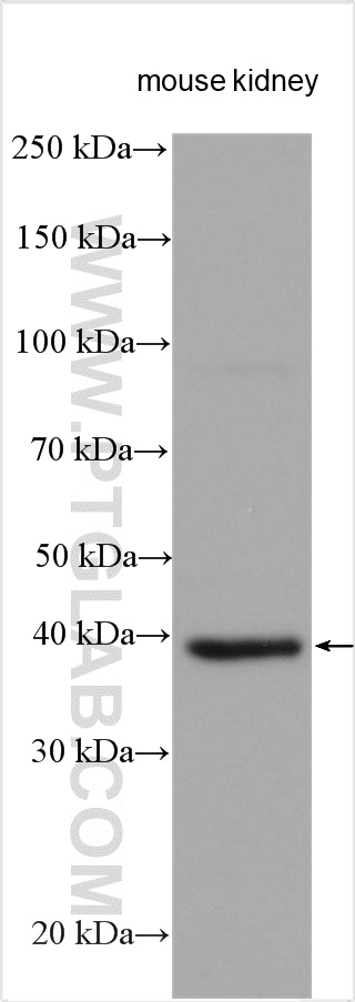 mouse kidney tissue were subjected to SDS PAGE followed by western blot with 20886-1-AP (FSP1 antibody) at dilution of 1:1500 incubated at room temperature for 1.5 hours.