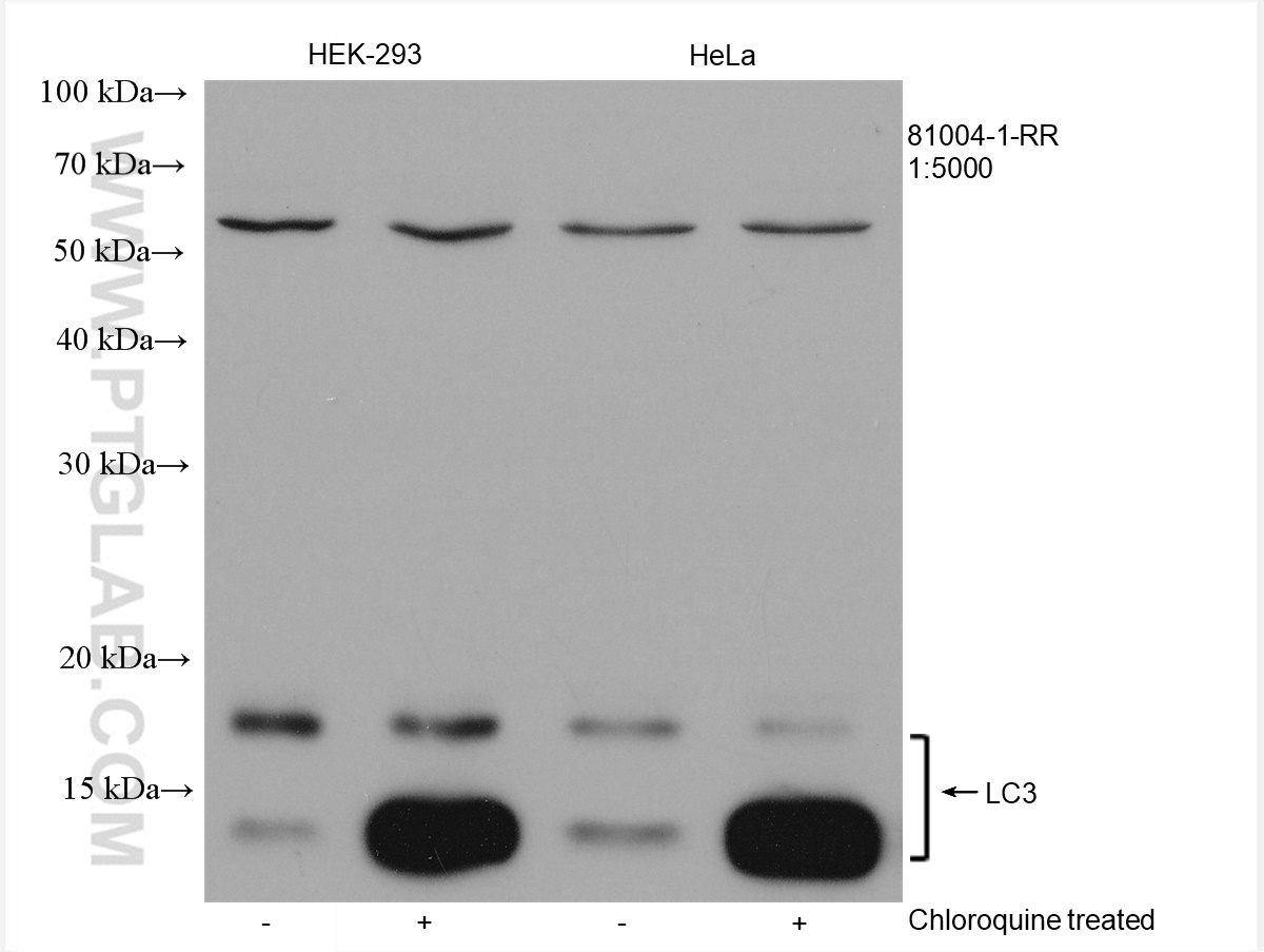 Untreated and chloroquine treated HEK-293 cells, untreated and chloroquine treated HeLa cells were subjected to SDS PAGE followed by western blot with 81004-1-RR (LC3 antibody) at dilution of 1:5000 incubated at room temperature for 1.5 hours.