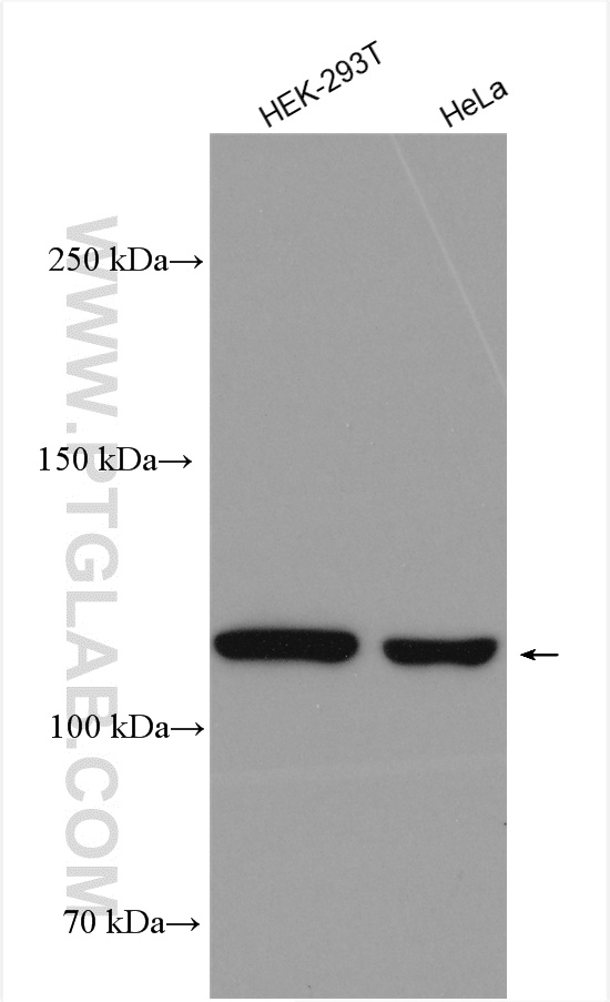 HEK-293T cells were subjected to SDS PAGE followed by western blot with 20986-1-AP (ULK1 antibody) at dilution of 1:3000 incubated at room temperature for 1.5 hours.