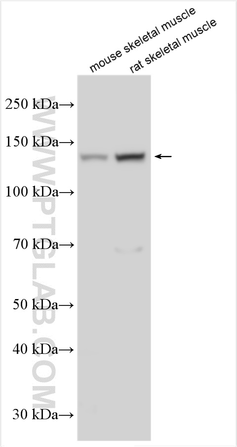Various lysates were subjected to SDS PAGE followed by western blot with 20986-1-AP (ULK1 antibody) at dilution of 1:1000 incubated at room temperature for 1.5 hours.