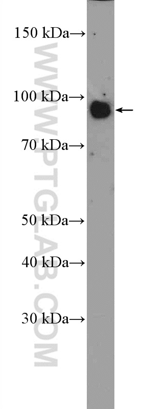 mouse brain tissue were subjected to SDS PAGE followed by western blot with 26276-1-AP (ATG9A Antibody) at dilution of 1:600  incubated at room temperature for 1.5 hours.