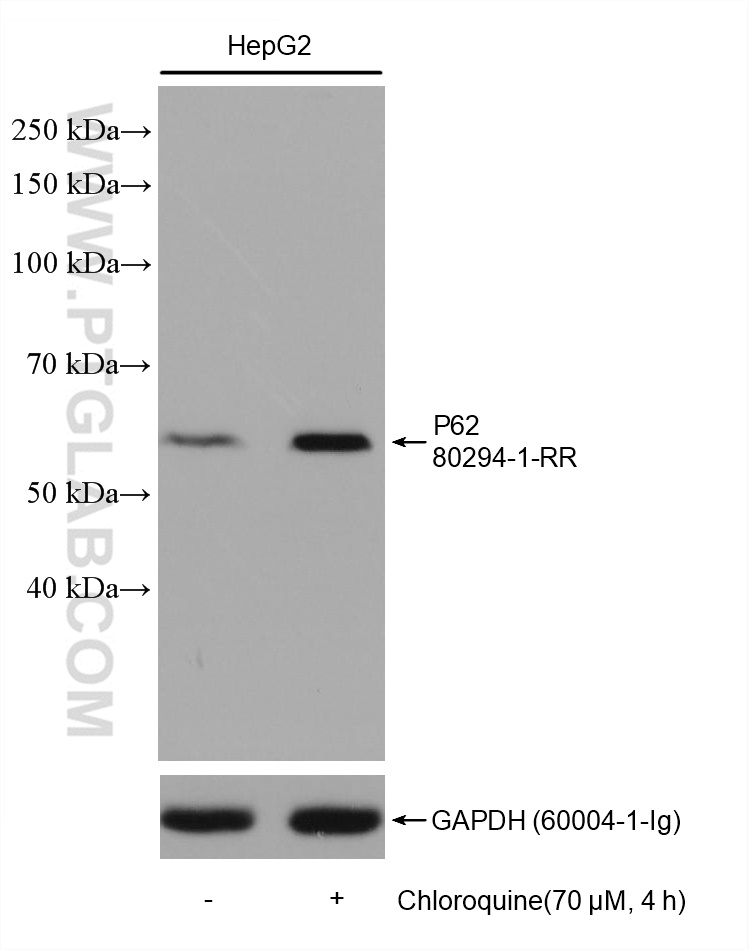 Lysates of HepG2 cells treated with Chloroquine or not were subjected to SDS PAGE followed by western blot with 80294-1-RR (P62,SQSTM1 antibody) at dilution of 1:5000 incubated at room temperature for 1.5 hours.