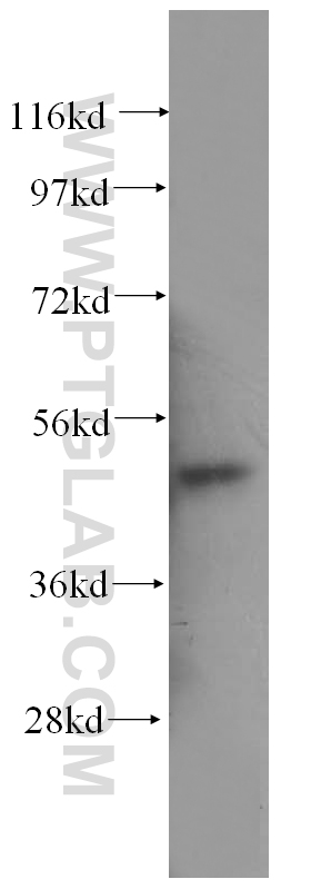 human bladder tissue were subjected to SDS PAGE followed by western blot with 11122-1-AP (ATG12 antibody) at dilution of 1:500  incubated at room temperature for 1.5 hours.