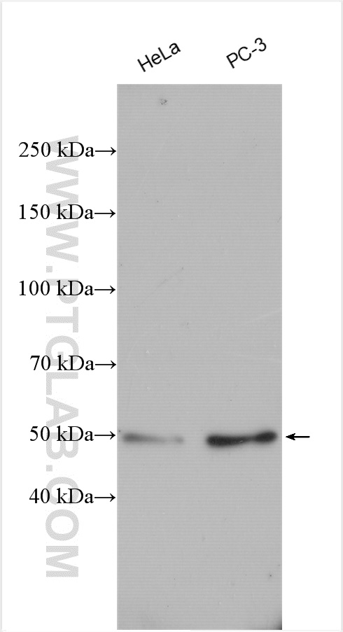 Various lysates were subjected to SDS PAGE followed by western blot with 11264-1-AP (ATG12 antibody) at dilution of 1:3000 incubated at room temperature for 1.5 hours.