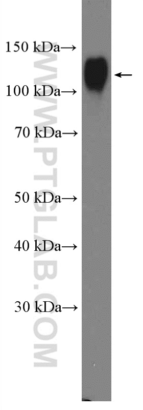 U-937 cells were subjected to SDS PAGE followed by western blot with 21997-1-AP (LAMP1 antibody at dilution of 1:2000  incubated at room temperature for 1.5 hours.
