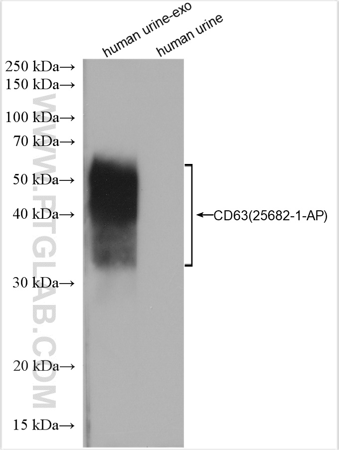 Human urine and human urine-derived exosomes (human urine-exo)  were subjected to SDS PAGE followed by western blot with 25682-1-AP (CD63 antibody) at dilution of 1:1000 incubated at room temperature for 1.5 hours.
