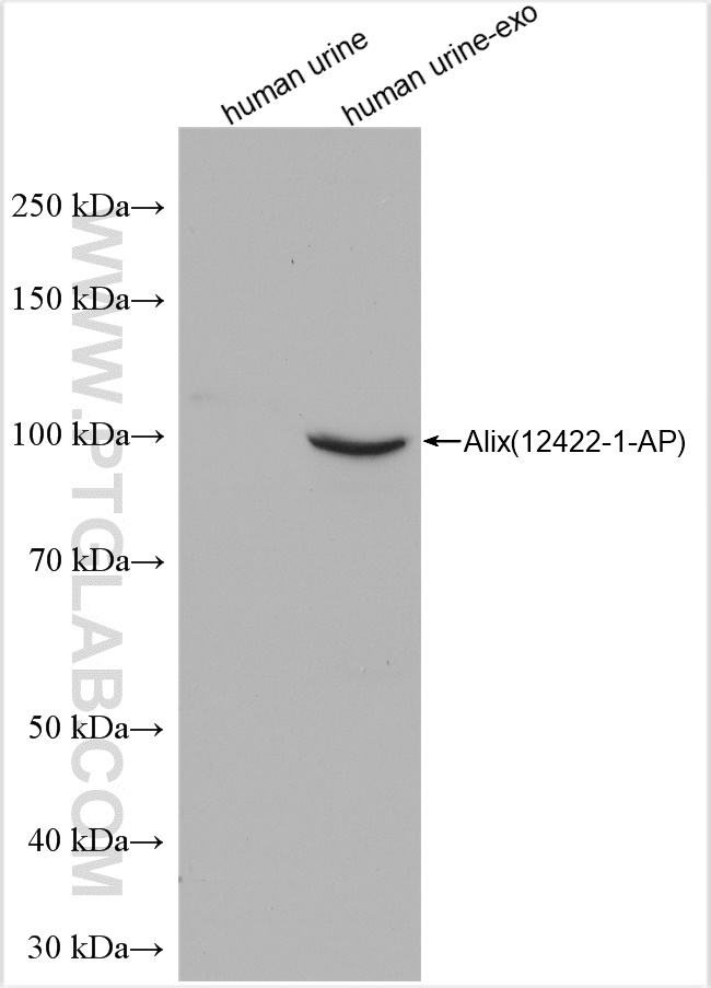 Human urine and human urine-derived exosomes (human urine-exo)   were subjected to SDS PAGE followed by western blot with 12422-1-AP (Alix antibody) at dilution of 1:10000 incubated at room temperature for 1.5 hours.