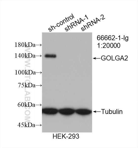 WB result of GOLGA2/GM130 antibody (66662-1-Ig; 1:20000; incubated at room temperature for 1.5 hours) with sh-Control and sh-GOLGA2/GM130 transfected HEK-293 cells.