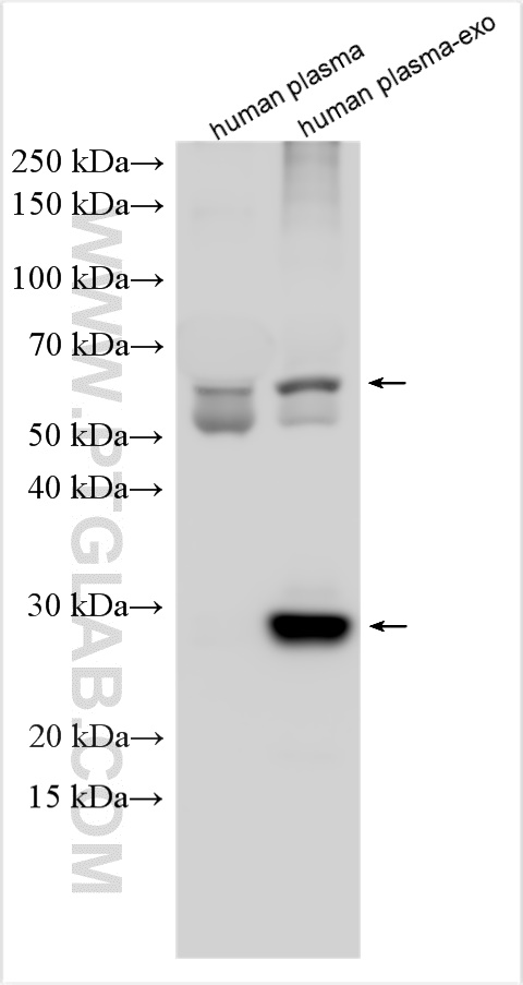 Human plasma and human plasma-derived exosomes (human plasma-exo) were subjected to SDS PAGE followed by western blot with 25682-1-AP (CD63 antibody) at dilution of 1:1000 incubated at room temperature for 1.5 hours.