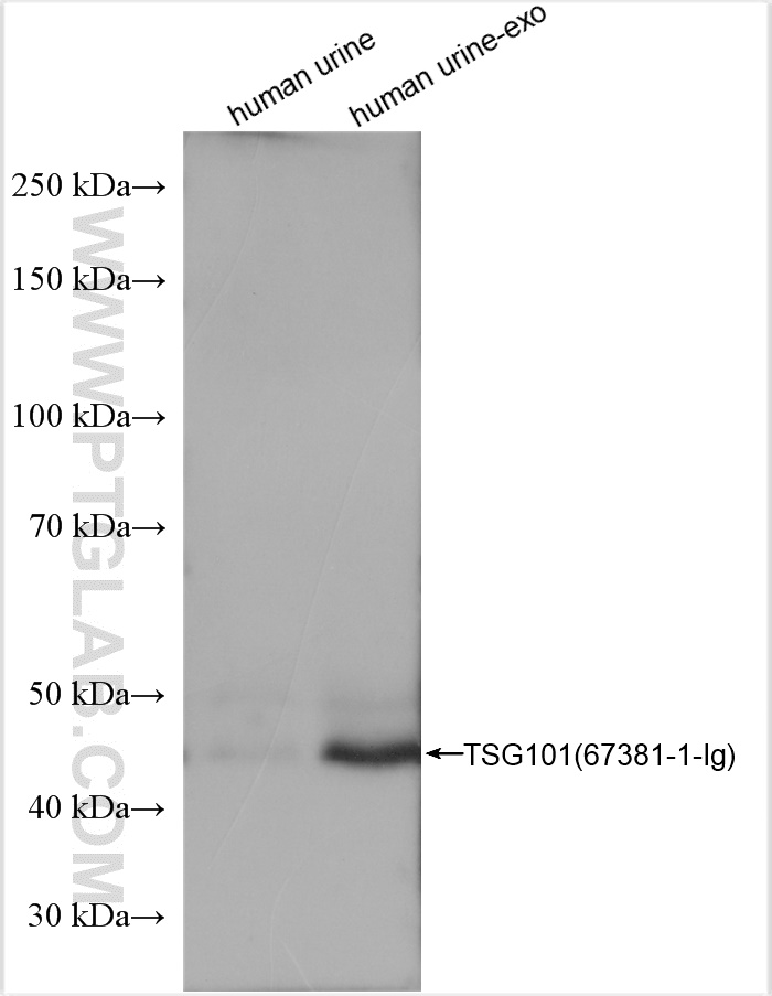 Human urine and human urine-derived exosomes (human urine-exo)  were subjected to SDS PAGE followed by western blot with 67381-1-Ig (TSG101 antibody) at dilution of 1:5000 incubated at room temperature for 1.5 hours.