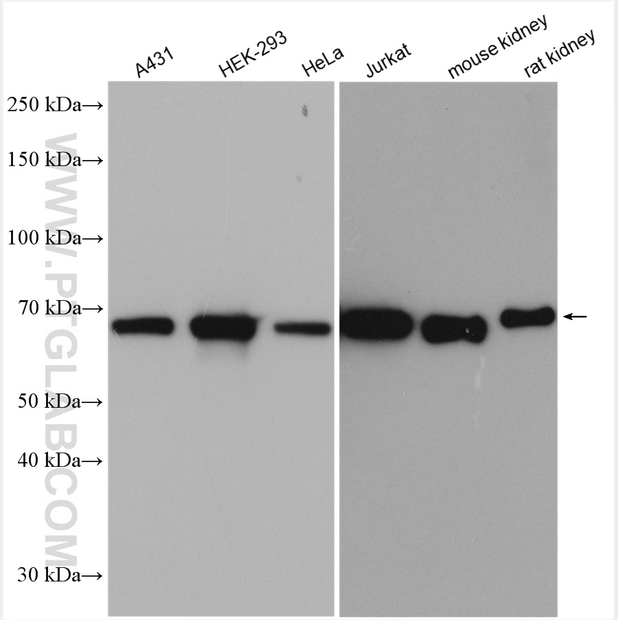 Various lysates were subjected to SDS PAGE followed by western blot with 10995-1-AP (HSP70 antibody) at dilution of 1:10000 incubated at room temperature for 1.5 hours.