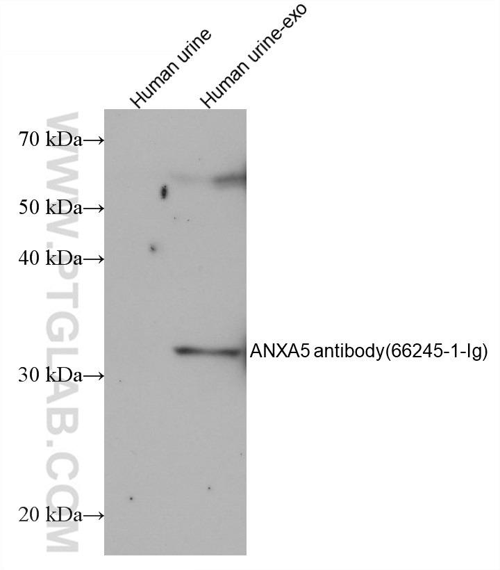 human urine exosomes tissue were subjected to SDS PAGE followed by western blot with 25682-1-AP (CD63 antibody) at dilution of 1:1000 incubated at room temperature for 1.5 hours.