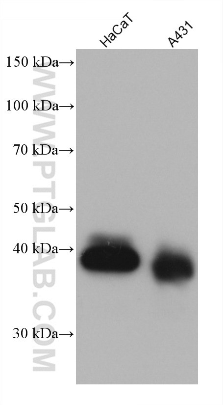 Various lysates were subjected to SDS PAGE followed by western blot with 66316-1-Ig (EPCAM antibody) at dilution of 1:5000 incubated at room temperature for 1.5 hours.