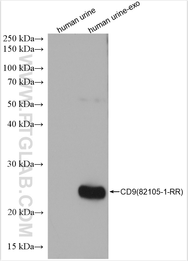 Human urine and human urine-derived exosomes (human urine-exo)   were subjected to SDS PAGE followed by western blot with 82105-1-RR (CD9 antibody) at dilution of 1:5000 incubated at room temperature for 1.5 hours.