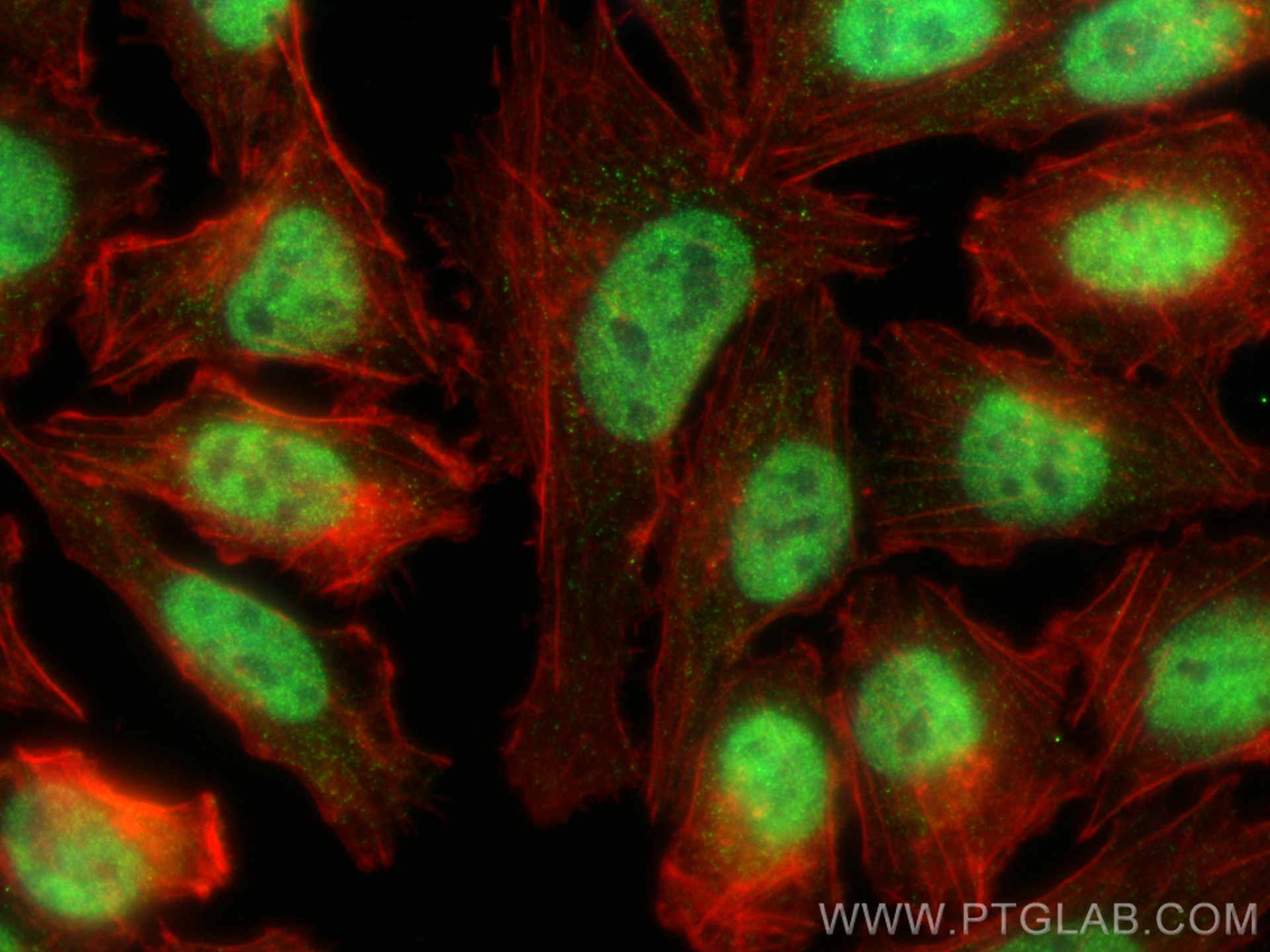 Immunofluorescence (IF) / fluorescent staining of A375 cells using WBP2 Polyclonal antibody (12030-1-AP)