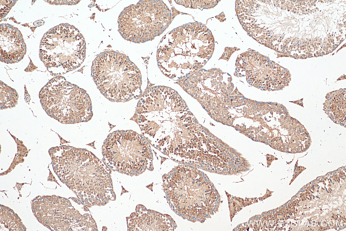 Immunohistochemistry (IHC) staining of mouse testis tissue using WBP2 Polyclonal antibody (12030-1-AP)