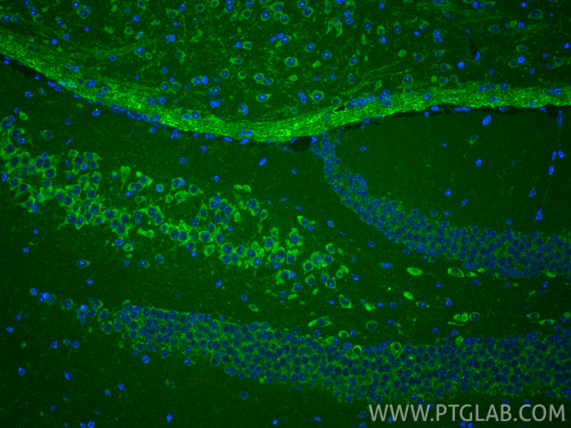 Immunofluorescence (IF) / fluorescent staining of mouse brain tissue using WBSCR16 Polyclonal antibody (13796-1-AP)
