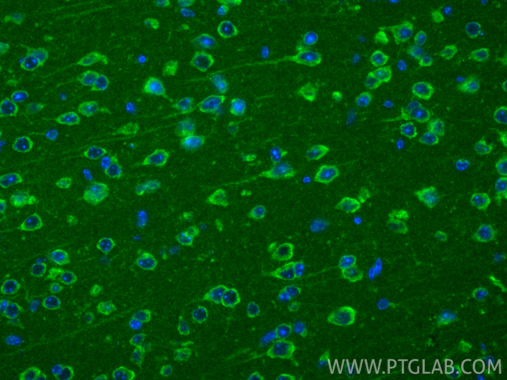 Immunofluorescence (IF) / fluorescent staining of mouse brain tissue using WBSCR16 Polyclonal antibody (13796-1-AP)