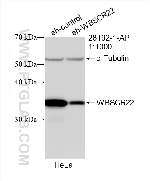 Western Blot (WB) analysis of HeLa cells using WBSCR22 Polyclonal antibody (28192-1-AP)