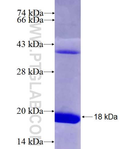 WBSCR22 fusion protein Ag28107 SDS-PAGE