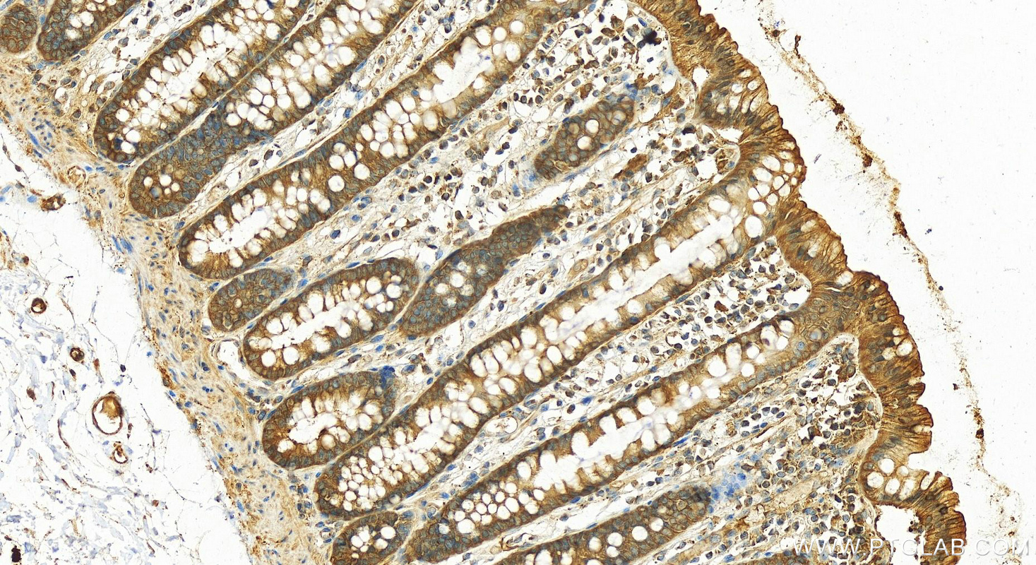 Immunohistochemistry (IHC) staining of human colon tissue using WDR1 Polyclonal antibody (13676-1-AP)